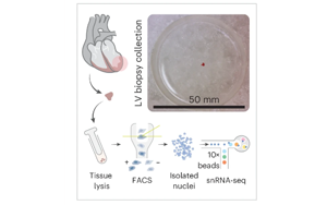 Nature Cardiovascular Research:心臟炎癥的關(guān)鍵差異 Nature Cardiovascular Research:心臟炎癥的關(guān)鍵差異