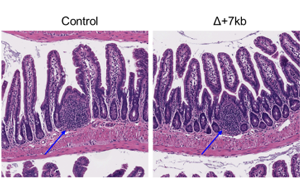 Nature:科學家新發現一種免疫細胞類型,與過敏有關 Nature:科學家新發現一種免疫細胞類型,與過敏有關