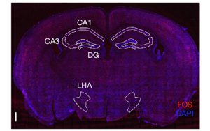 Nature:科學家發現記憶如何控制新陳代謝 Nature:科學家發現記憶如何控制新陳代謝