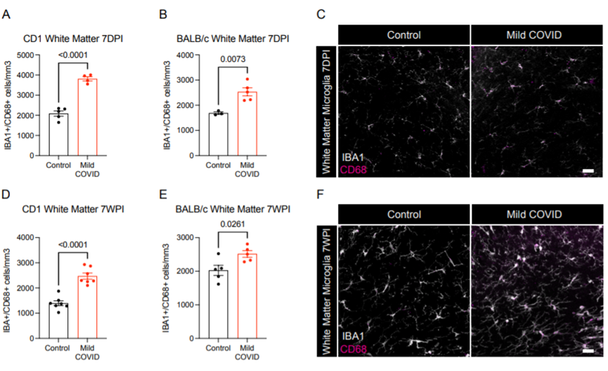 新冠竟能“傷腦”?耶魯科學家找到SARS-CoV-2損害神經系統(tǒng)新證據 新冠竟能“傷腦”?耶魯科學家找到SARS-CoV-2損害神經系統(tǒng)新證據