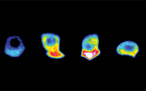 Developmental Cell:為入侵細胞的“前線”提供燃料 Developmental Cell:為入侵細胞的“前線”提供燃料