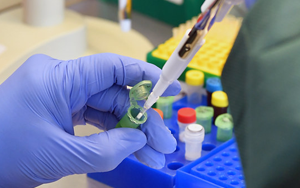 分子診斷用酶原料一站式服務盡在西寶生物 分子診斷用酶原料一站式服務盡在西寶生物