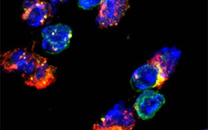 《Nature Immunology》兩種不同類型的免疫細胞幫助20億人控制結核病 《Nature Immunology》兩種不同類型的免疫細胞幫助20億人控制結核病