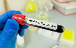 α-L-巖藻糖苷酶（AFU）檢測試劑盒用原輔料