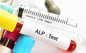 堿性磷酸酶(ALP/AKP)檢測試劑盒用原輔料 堿性磷酸酶(ALP/AKP)檢測試劑盒用原輔料
