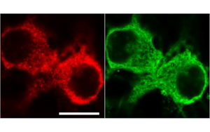 《PNAS》從過度反應蛋白合成到認知障礙，敲除1個基因即可