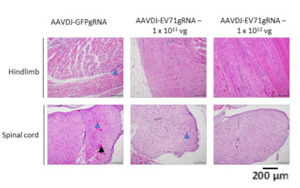 新加坡科學家開發基因編輯技術,消除EV-A71 RNA病毒 新加坡科學家開發基因編輯技術,消除EV-A71 RNA病毒