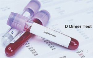 D-二聚體(D-Dimer)-磁微粒化學發光法(吖啶酯) /熒光免疫層析解決方案 D-二聚體(D-Dimer)-磁微粒化學發光法(吖啶酯) /熒光免疫層析解決方案