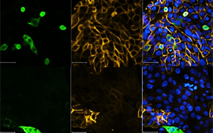 Nature最新研究表明,一類新的抗病毒藥物可以對抗SARS-CoV-2 Nature最新研究表明,一類新的抗病毒藥物可以對抗SARS-CoV-2