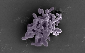 Science Immunology:一種腸道細(xì)菌可以增強(qiáng)免疫反應(yīng),增強(qiáng)癌癥免疫治療 Science Immunology:一種腸道細(xì)菌可以增強(qiáng)免疫反應(yīng),增強(qiáng)癌癥免疫治療