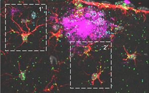 《Nature Neuroscience》可增強(qiáng)神經(jīng)膠質(zhì)細(xì)胞的蛋白質(zhì) 《Nature Neuroscience》可增強(qiáng)神經(jīng)膠質(zhì)細(xì)胞的蛋白質(zhì)